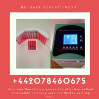 HD Hair Replacement image 6